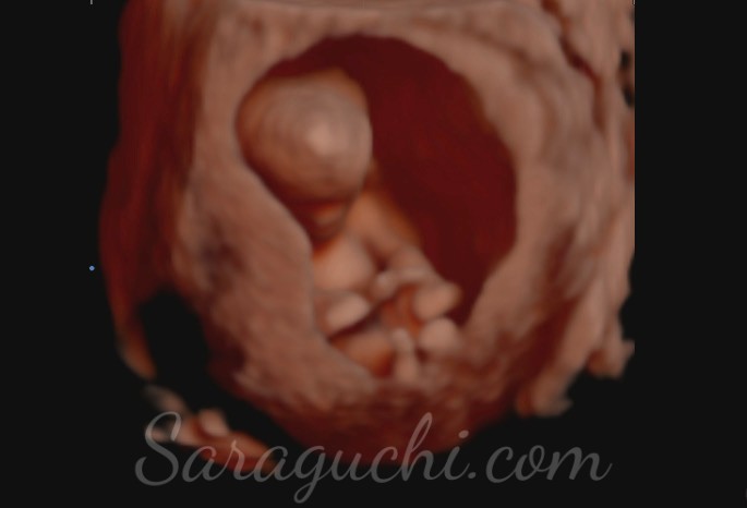 Ecografía 5D del primer trimestre de embarazo (semana 12)